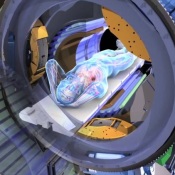 “Wildly Compelling” MRI-Guided Radiation Therapy! ViewRay (VRAY, NASDAQ)